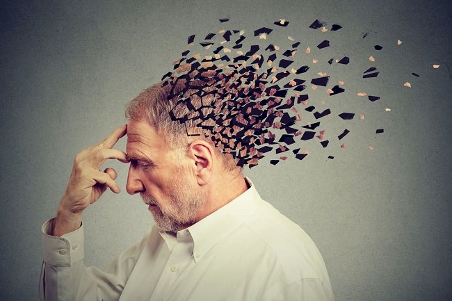 Ilustrasi Alzheimer. Hari Alzheimer Sedunia diperingati pada 21 September. Alzheimer adalah penyakit paling umum penyebab demensia dan seiring terjadi pada lanjut usia.(SHUTTERSTOCK) Ilustrasi Alzheimer. Hari Alzheimer Sedunia diperingati pada 21 September. Alzheimer adalah penyakit paling umum penyebab demensia dan seiring terjadi pada lanjut usia.(SHUTTERSTOCK)
